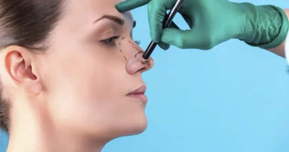 Rinoplastia caseira: Técnica com maquiagem disfarça o nariz grande instantaneamente