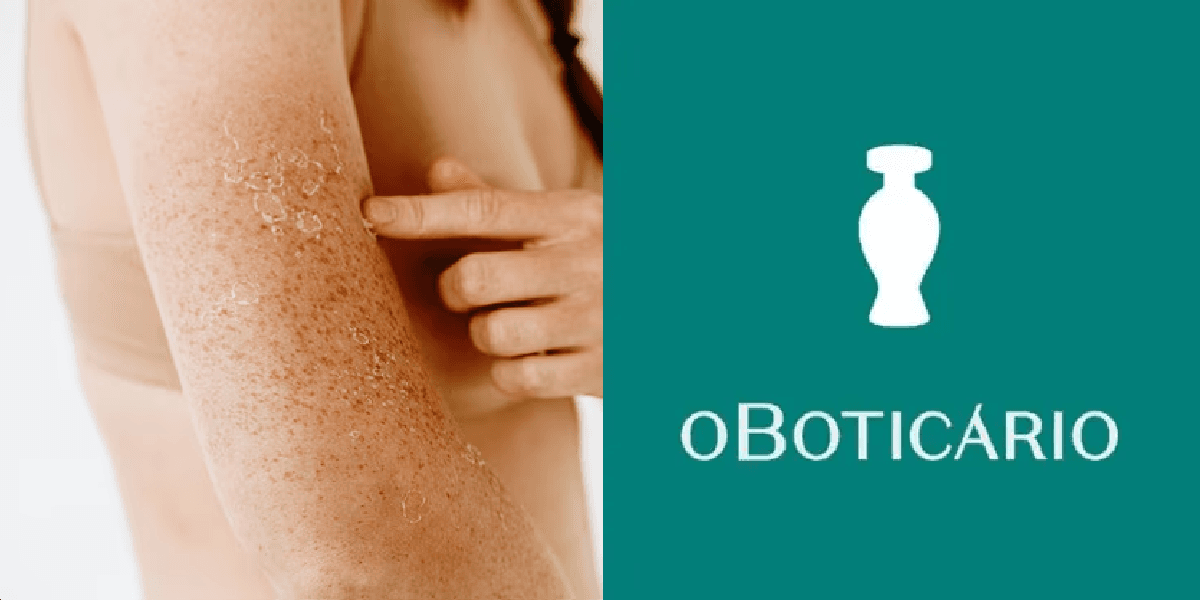 Resultado de 2 a 3 dias: 2 produtos do Boticário que combatem o ressecamento da pele e hidratam profundamente