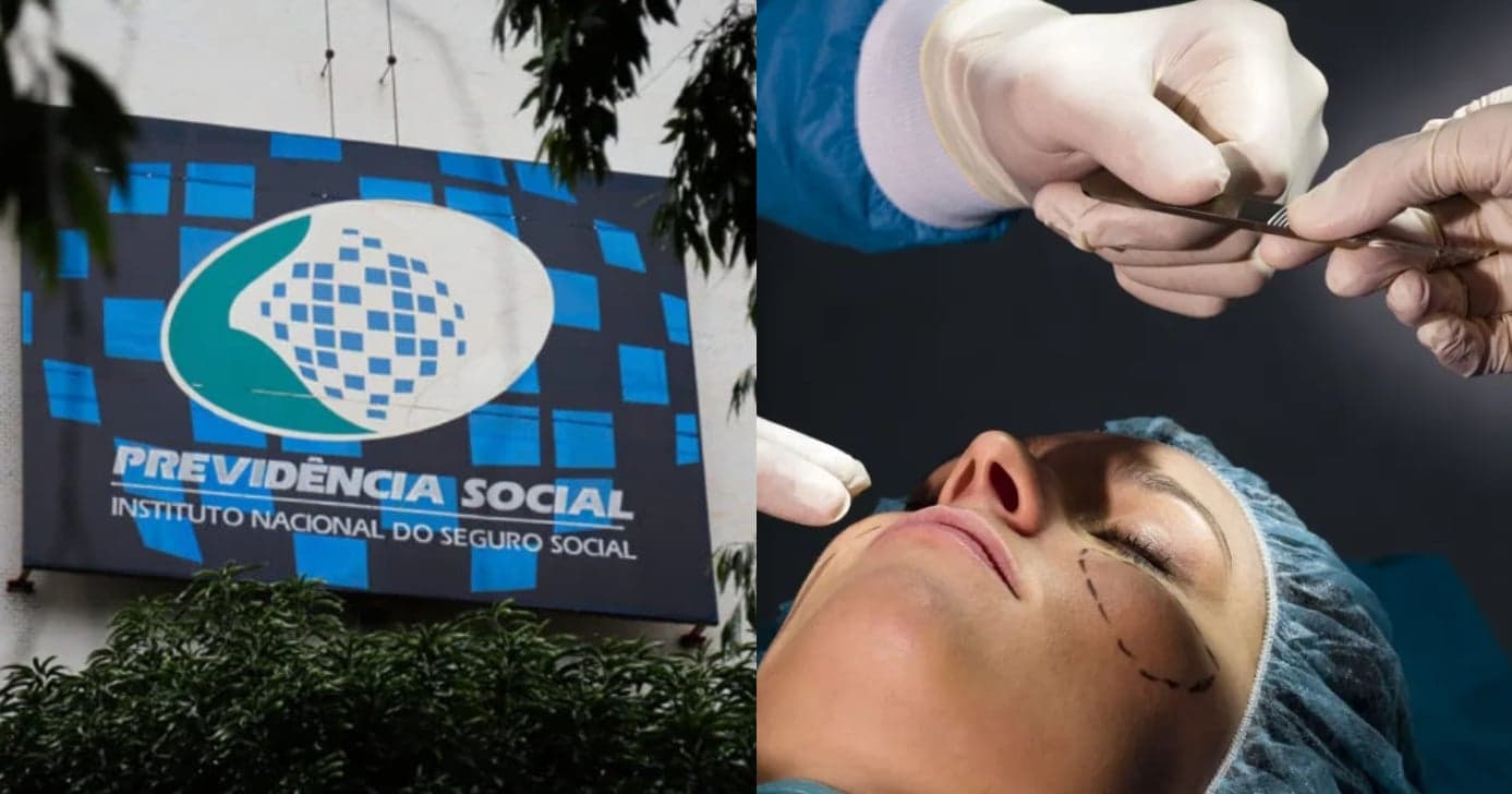 Auxílio-doença liberado: 3 tipos de plástica que garantem liberação de salário pelo INSS