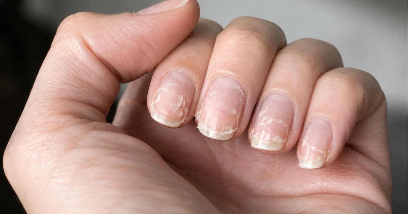 Nem manicure resolve: 5 hábitos que deixam as unhas das mulheres descascando