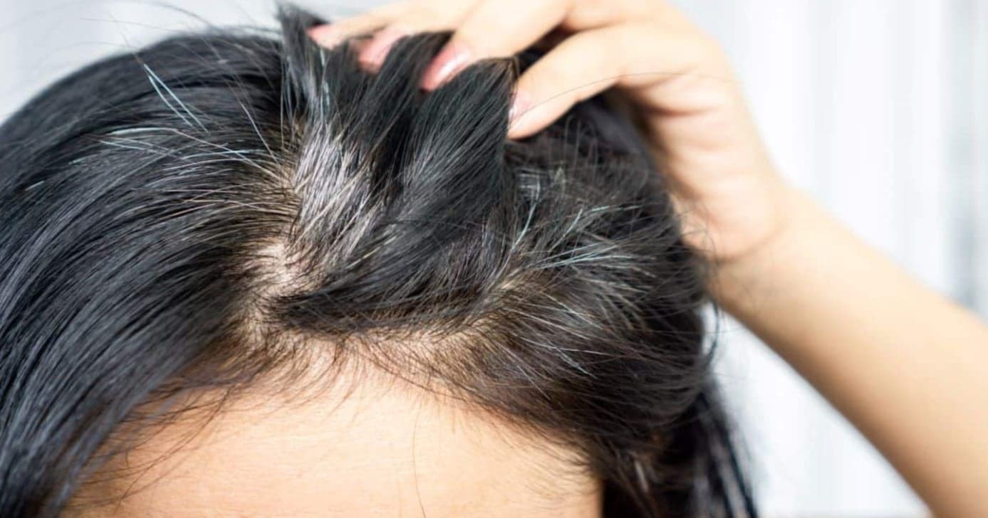 Tinta caseira com óleo de coco escurece fios brancos e rejuvenesce sem química