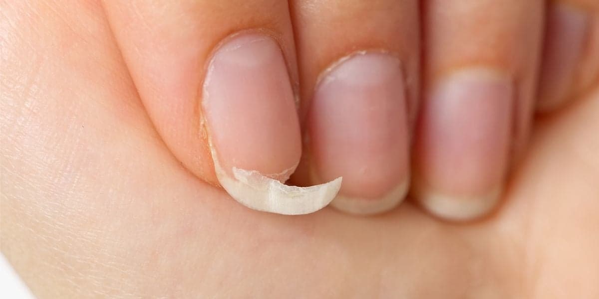 Unhas quebradas revertidas com papel higiênico (Reprodução: Divulgação)