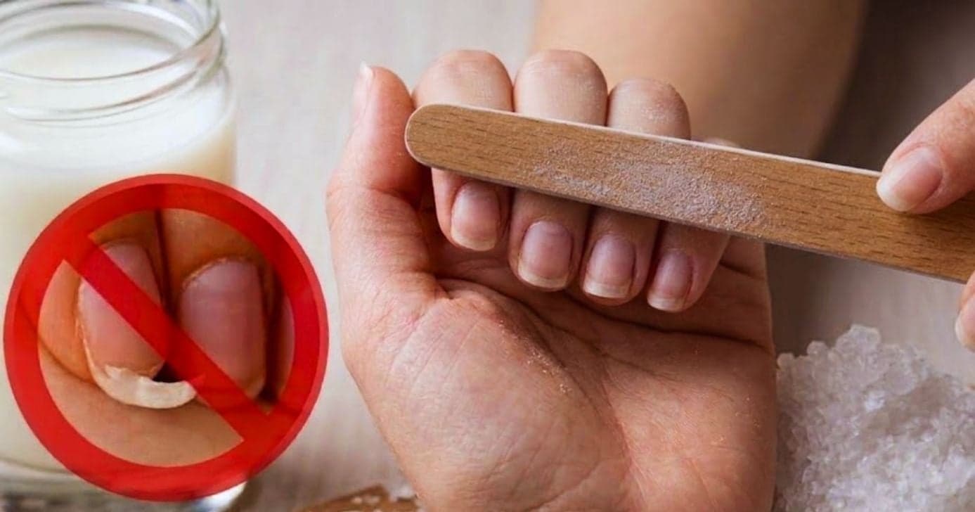 Para cuidar das unhas em casa: 3 melhores aliados contra quebra e ressecamento