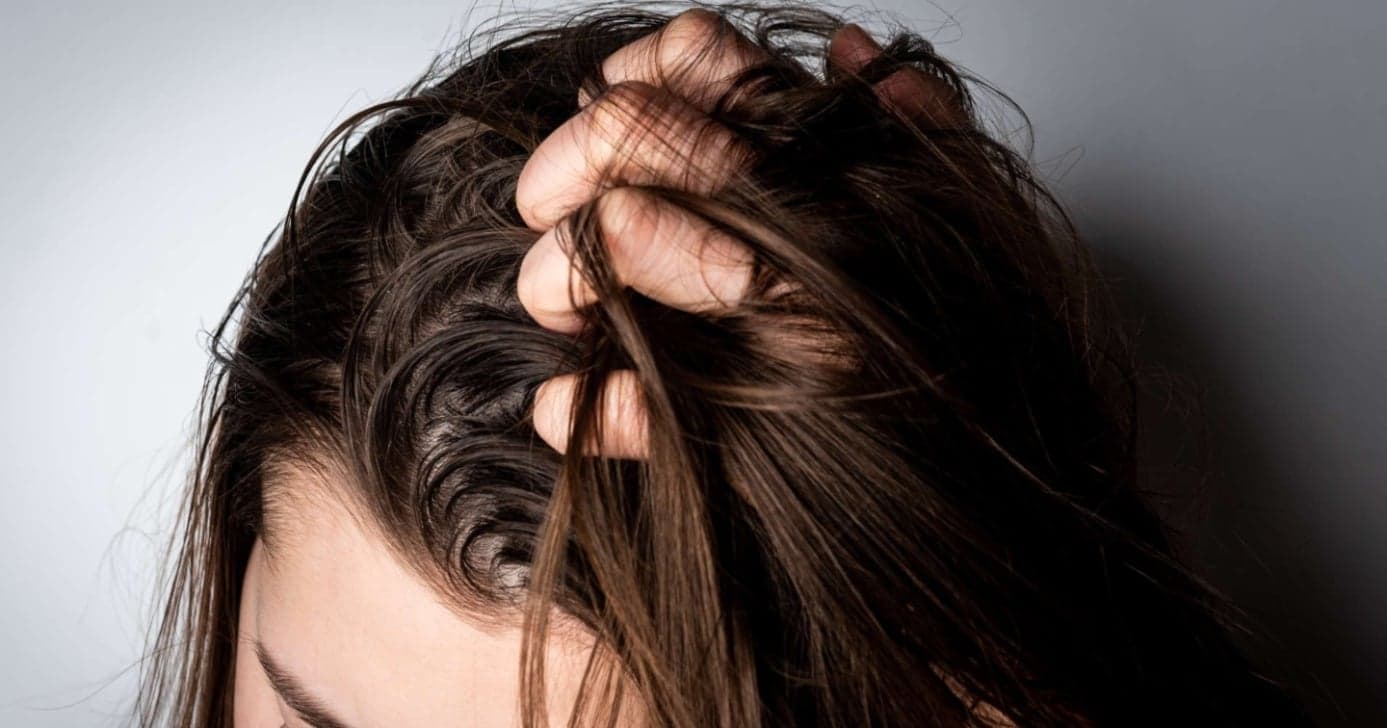Cabelo sujo e com suor (Foto: Reprodução/Internet)