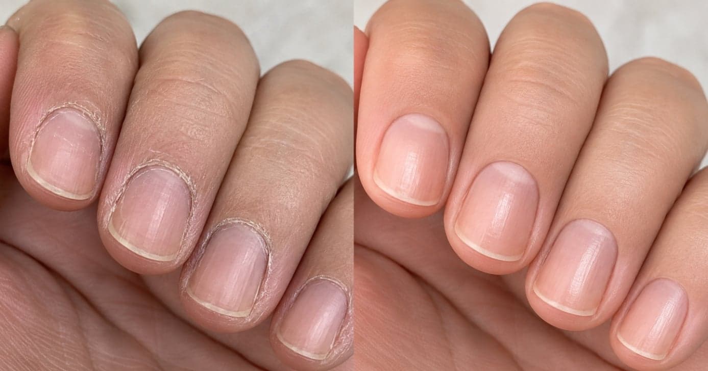 Cutículas ressecadas? Veja como cuidar delas em casa