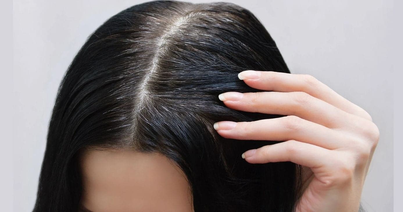 Acabou o grisalho: Óleo natural elimina o cabelo branco sem precisar de tinta ou salões