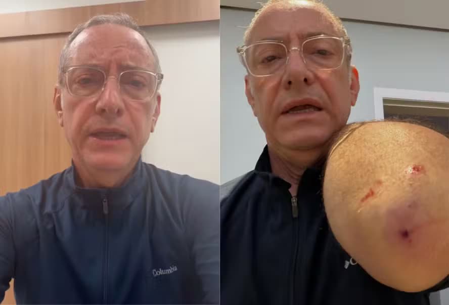 O jornalista José Roberto Burnier, da Globo, sofreu um ataque de pitbull (Foto: Reprodução/Instagram)