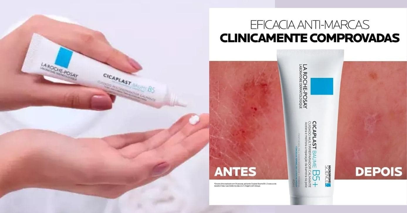 La Roche-Posay Cicaplast Baume B5 (Foto Reprodução/Montagem/Lennita/TV Foco/Canva/Google Shopping)