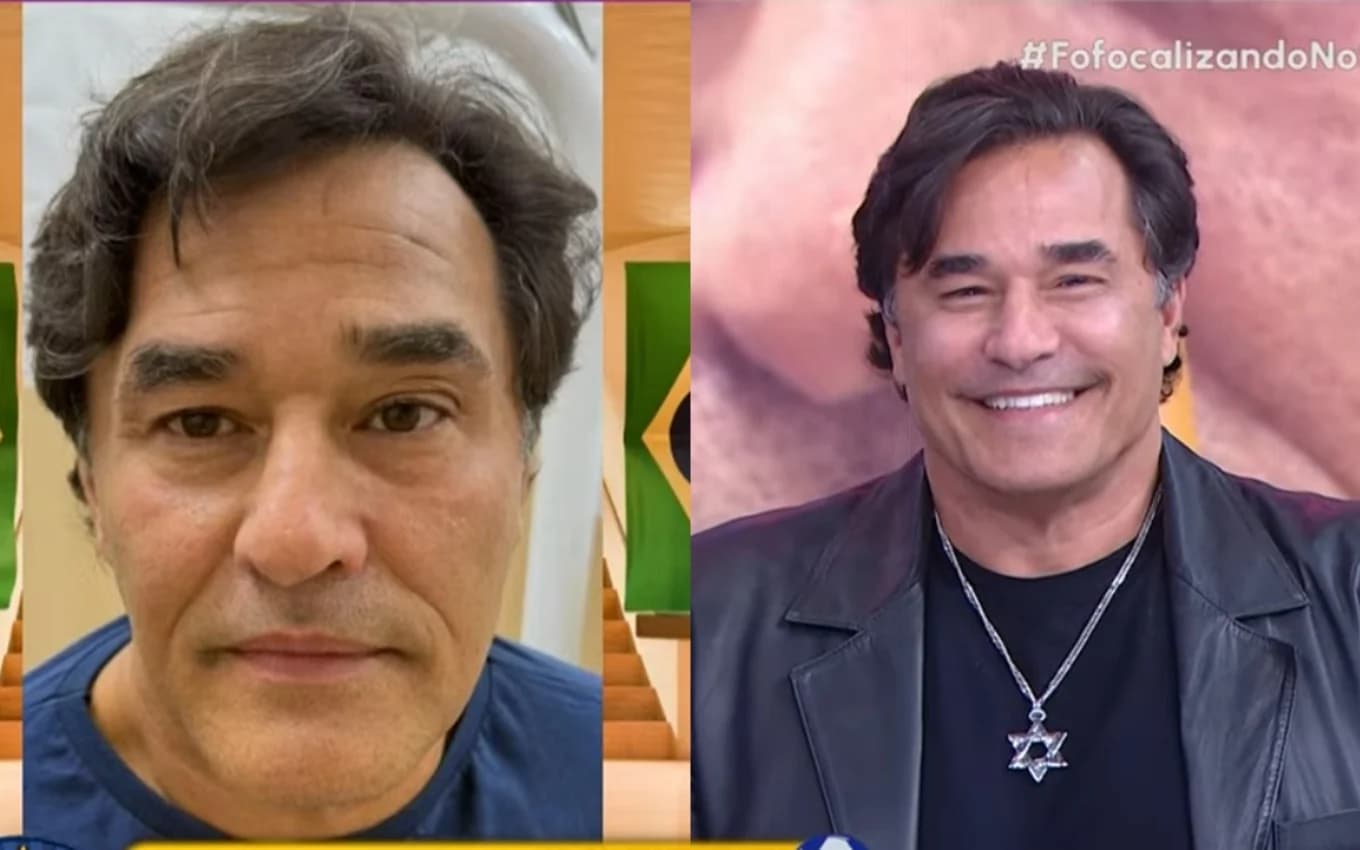Luciano Szafir se rendeu aos procedimentos estéticos (Foto: Reprodução/ SBT)