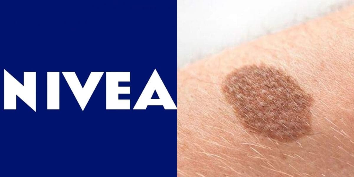 Sérum da Nívea apaga manchas escuras e uniformiza a pele em 2 semanas