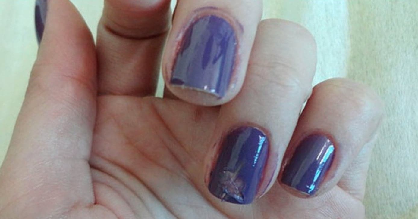Nada de voltar à manicure: Truque infalível conserta a unha borrada rapidamente