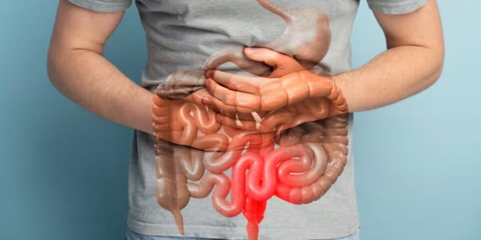 Ilustração dor abdominal (Foto: Canva) Ilustração dor abdominal (Foto: Canva)