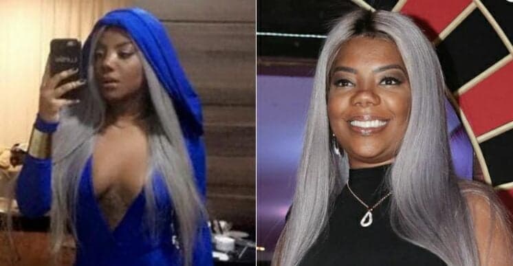 Ludmilla revela que fez plástica no nariz aos 17 anos