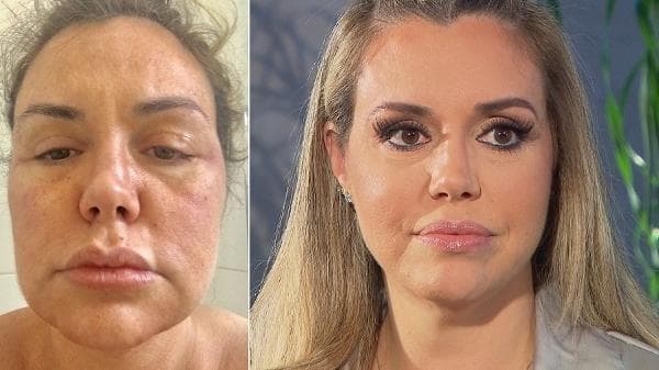 Imagem do post Imagem do post