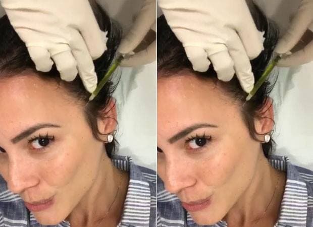 Juliana Knust faz tratamento para queda de cabelo assim como Ana Furtado (Foto reprodução) Juliana Knust faz tratamento para queda de cabelo assim como Ana Furtado (Foto reprodução)