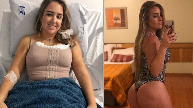 Patrícia, do BBB18, fez lipoescutura, colocou silicone nos seios e injetou gordura no bumbum (Foto: Reprodução/Instagram) Patrícia, do BBB18, fez lipoescutura, colocou silicone nos seios e injetou gordura no bumbum (Foto: Reprodução/Instagram)