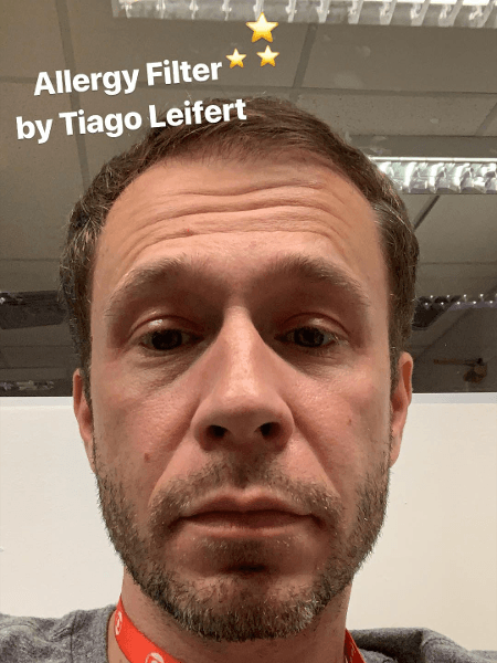 Tiago Leifert teve ataque de alergia (Foto: Reprodução/ Instagram) Tiago Leifert teve ataque de alergia (Foto: Reprodução/ Instagram)