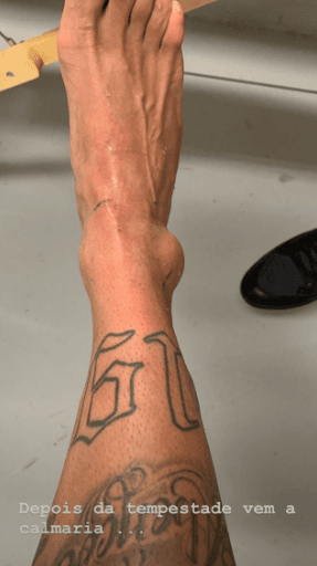 Neymar posta foto provando o quanto se machucou e deixa fãs chocados: "ficou horrível gente"Foto: Reprodução Neymar posta foto provando o quanto se machucou e deixa fãs chocados: "ficou horrível gente"Foto: Reprodução