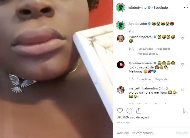 Jojo Todynho leva picada na boca e se diverte com situação: ''Parece que fiz preenchimento labial'' Jojo Todynho leva picada na boca e se diverte com situação: ''Parece que fiz preenchimento labial''