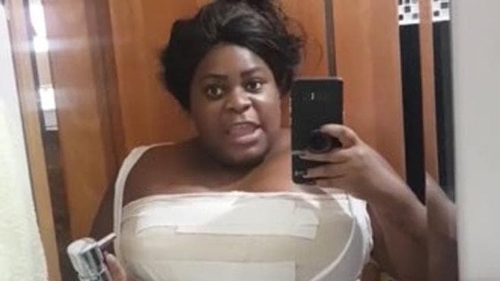 Jojo Todynho muda o visual, coloca silicone nos seios e sofre complicações sérias: "Cicatriz"