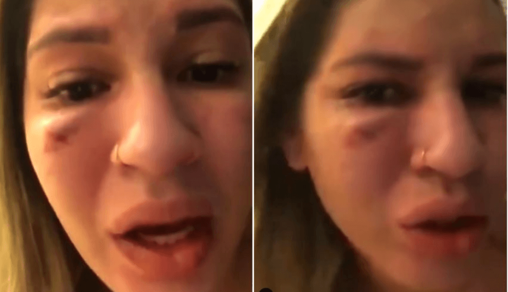Famoso é acusado de agressão e esposa se tranca no banheiro para implorar por ajuda após ser espancada