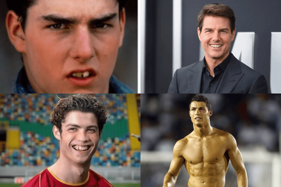 De horripilantes à maravilhosos: Famosos provam que dinheiro não traz felicidade mas proporciona beleza