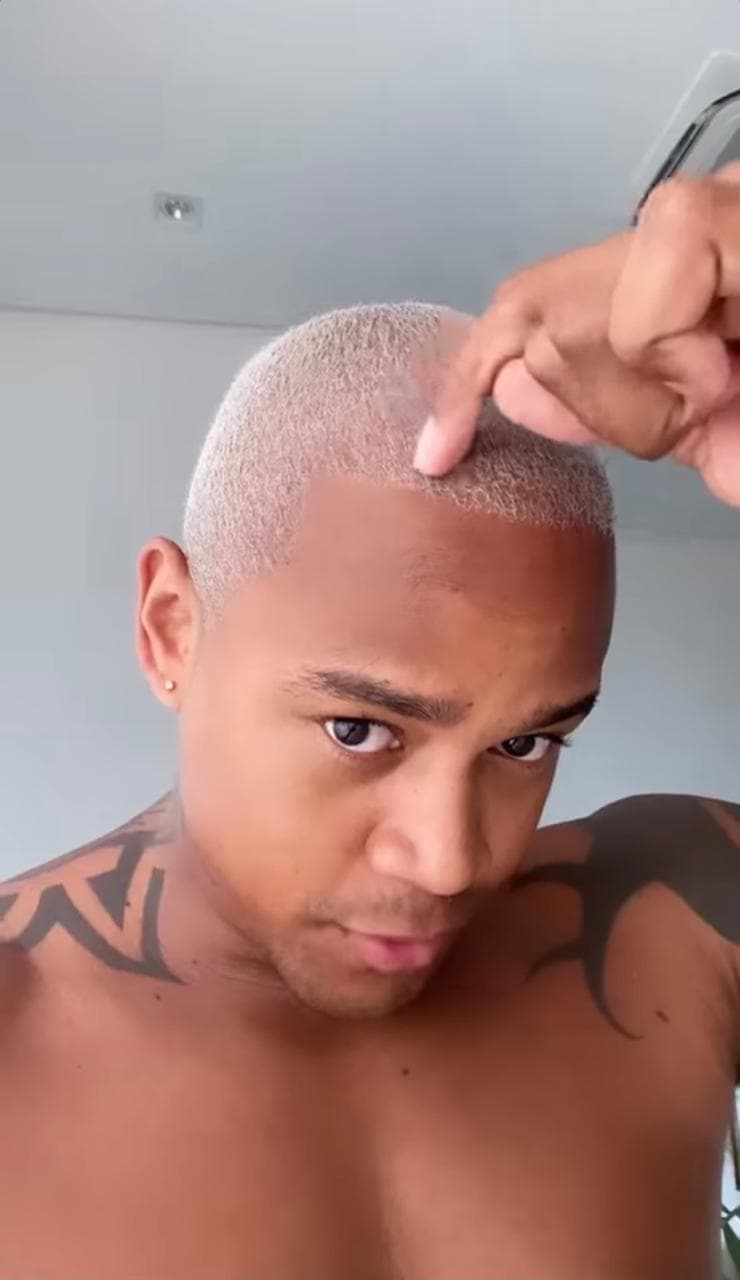 Artista aparece sem camisa para celebrar transplante capilar (Reprodução: Instagram) Artista aparece sem camisa para celebrar transplante capilar (Reprodução: Instagram)