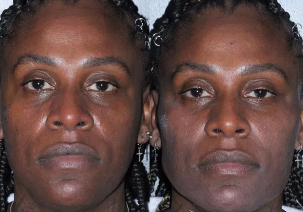 Pepê e Neném fazem harmonização facial (Reprodução) Pepê e Neném fazem harmonização facial (Reprodução)