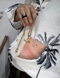 Adriane Bonato mostra hematomas após assalto contra ela e Claudia Rodrigues (Foto: Reprodução) Adriane Bonato mostra hematomas após assalto contra ela e Claudia Rodrigues (Foto: Reprodução)