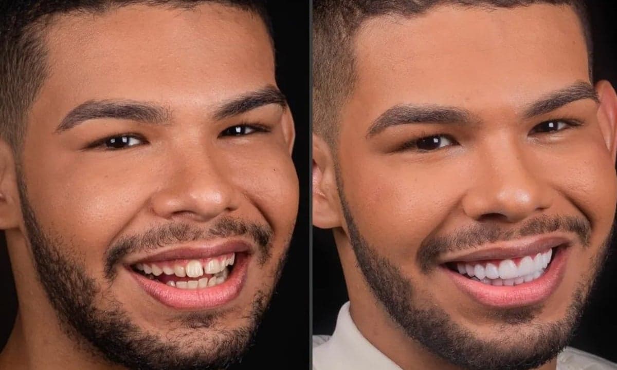 Conceituado nas redes, Vyni exibe seu novo sorriso conquistado com a fama e fortuna Conceituado nas redes, Vyni exibe seu novo sorriso conquistado com a fama e fortuna