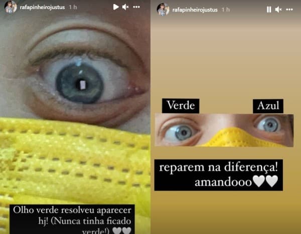 Rafaella Justus, filha de Ticiane Pinheiro, mostra diferença dos olhos em foto no Instagram (foto: Instagram) Rafaella Justus, filha de Ticiane Pinheiro, mostra diferença dos olhos em foto no Instagram (foto: Instagram)