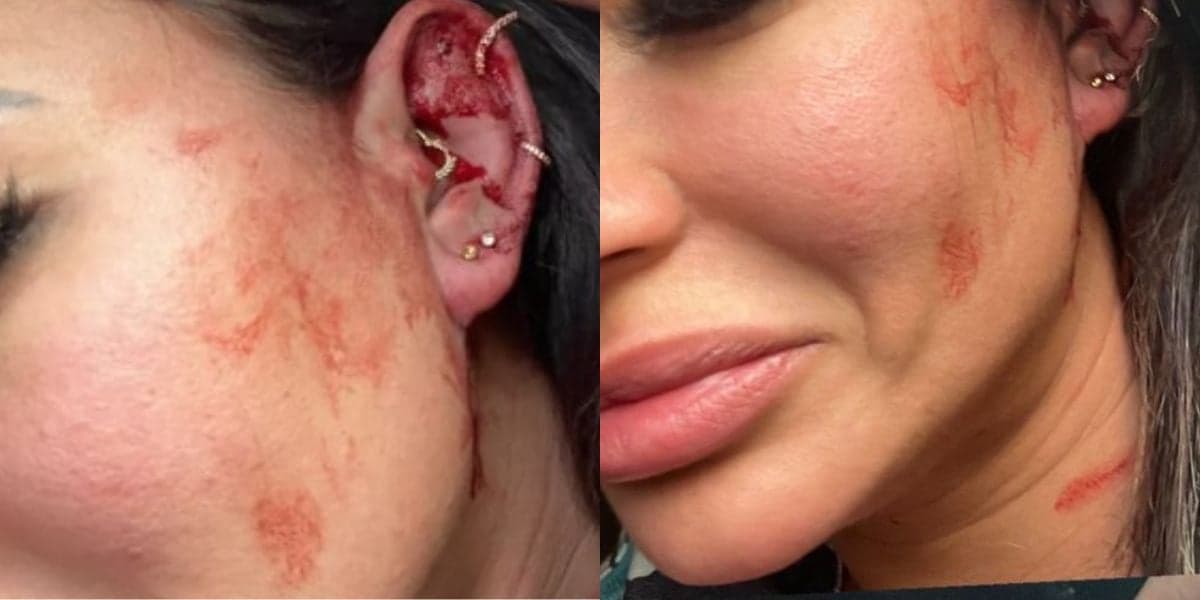 Milena Lins fez vídeos no Instagram para desabafar sobre relacionamento abusivo - Reprodução Instagram Milena Lins fez vídeos no Instagram para desabafar sobre relacionamento abusivo - Reprodução Instagram