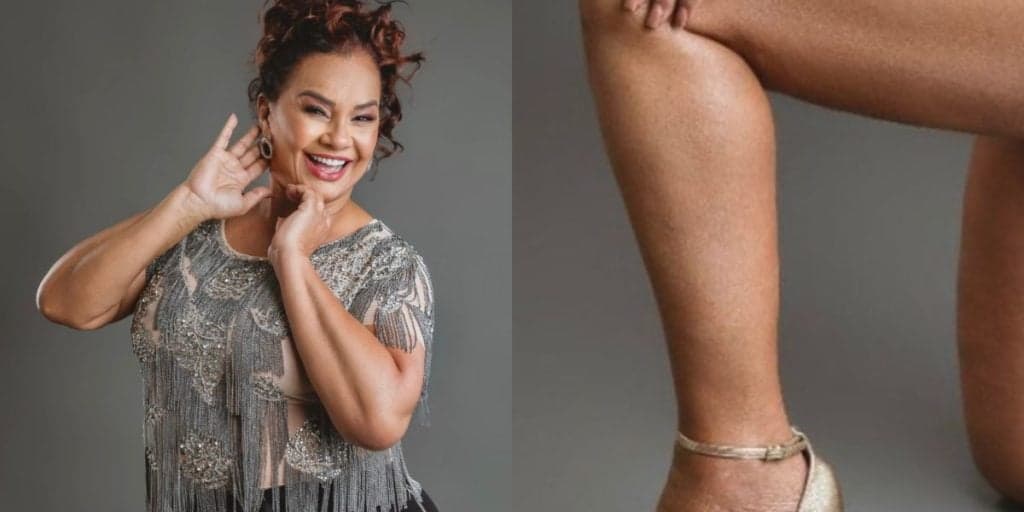 Aos 65 anos, Solange Couto exibe coxa dura e bumbum gigante e prova que deixa muita menininha no chinelo