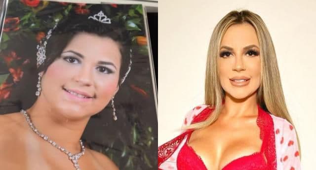 As cirurgias plásticas em ‘A Fazenda 14’: Pioneiro da lipoaspiração no Brasil fala sobre os procedimentos já feitos pelos participantes