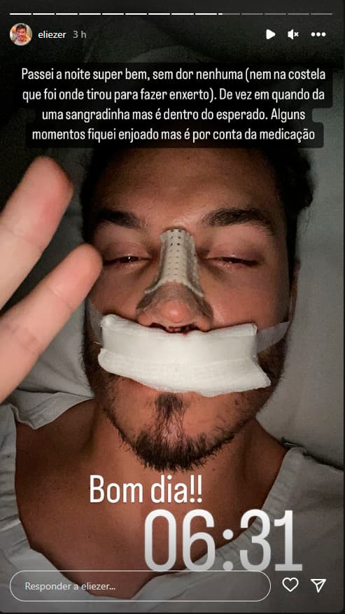 Eliezer mostra pós operatório de rinoplastia (Foto: Reprodução/Instagram) Eliezer mostra pós operatório de rinoplastia (Foto: Reprodução/Instagram)