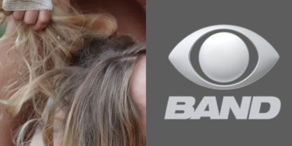 Barraco! Loira famosa, que tem caso com apresentador da Band, passa por reforma, após surra da esposa dele