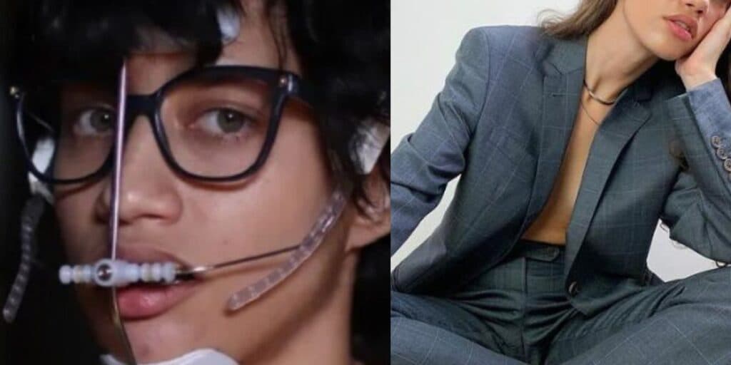 Atriz da Globo, que era cheia de aparelhos, hoje é com certeza uma das mulheres mais lindas do Brasil