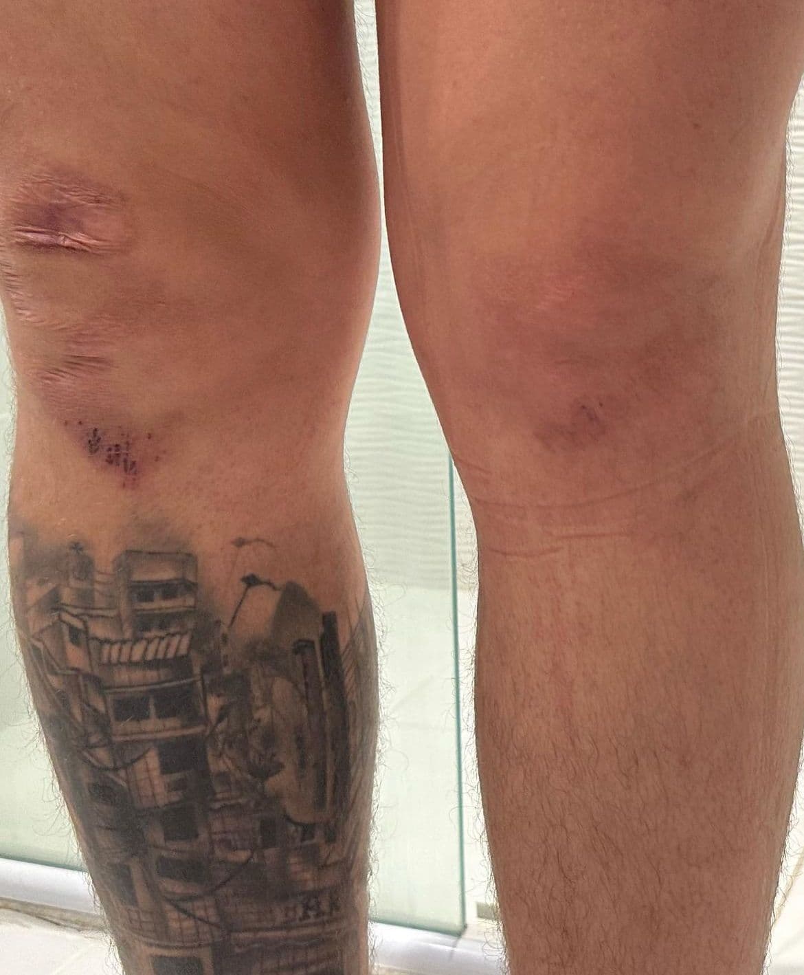 Mc Gui é internado às pressas para realizar cirurgia - Foto Reprodução Instagram Mc Gui é internado às pressas para realizar cirurgia - Foto Reprodução Instagram