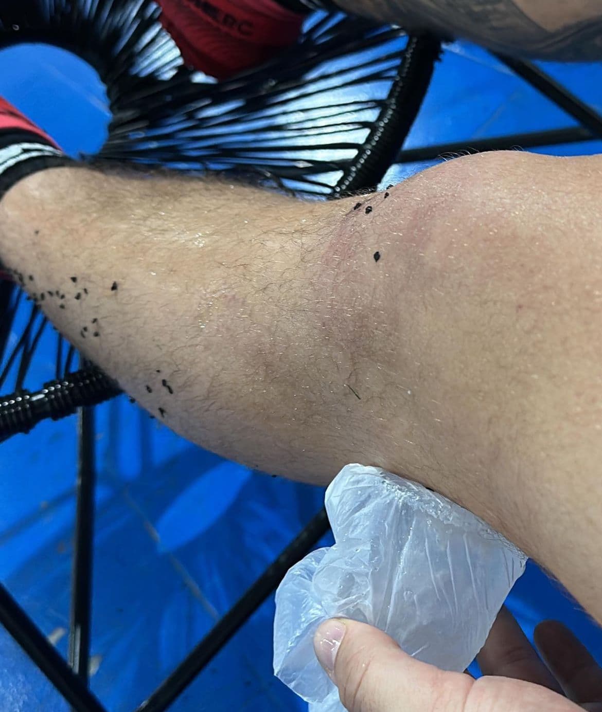 Mc Gui é internado às pressas para realizar cirurgia - Foto Reprodução Instagram Mc Gui é internado às pressas para realizar cirurgia - Foto Reprodução Instagram