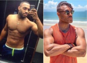 Marido de Fred expõe antes e depois de procedimento estético do brother (Foto: Reprodução / Instagram) Marido de Fred expõe antes e depois de procedimento estético do brother (Foto: Reprodução / Instagram)