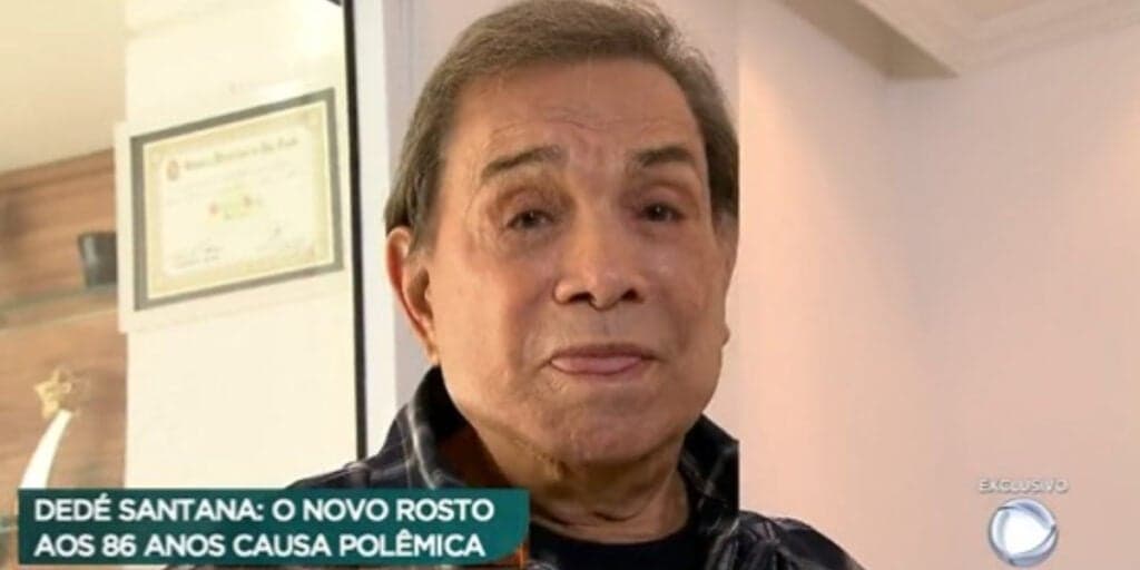 Novo rosto de Dedé Santana é mostrado no Domingo Espetacular e horroriza público: "Várias agulhadas"