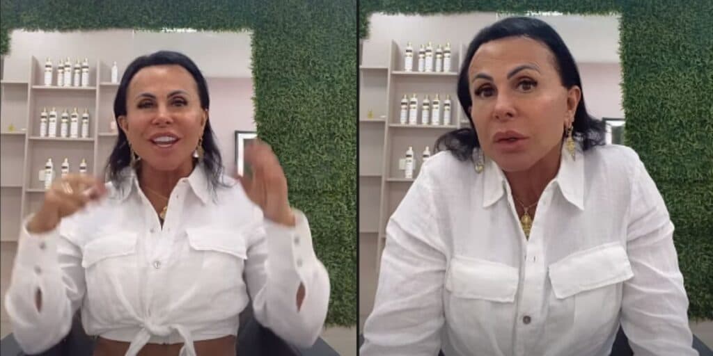 Gretchen entrega queda de cabelo, expõe calvície e passa por procedimento na cabeça: "Continuarei fazendo"