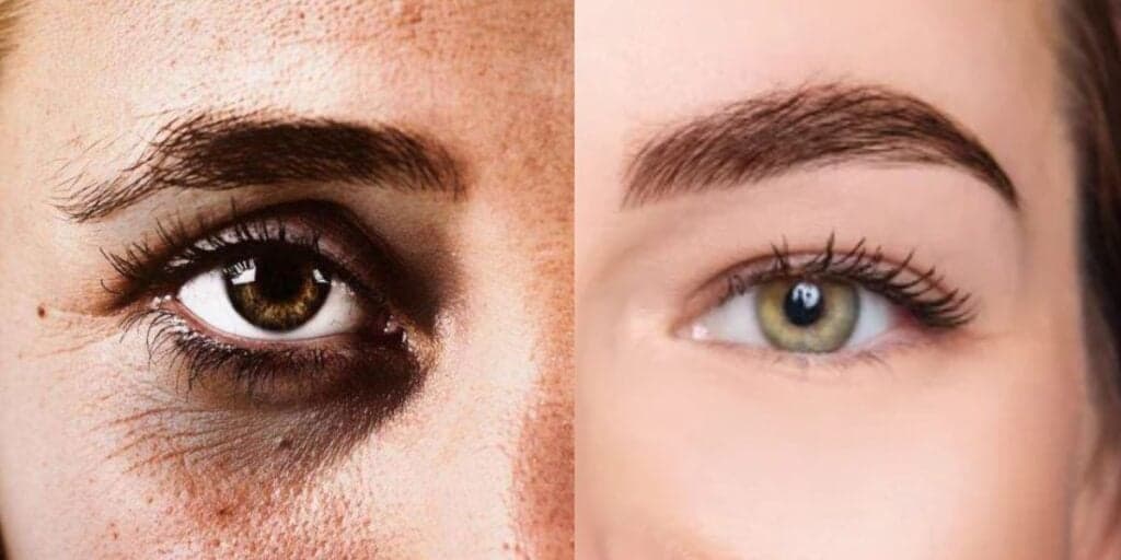 Fim das rugas e olheiras: 3 misturinhas caseiras deixam o colágeno no chinelo e te rejuvenescem em até 20 anos