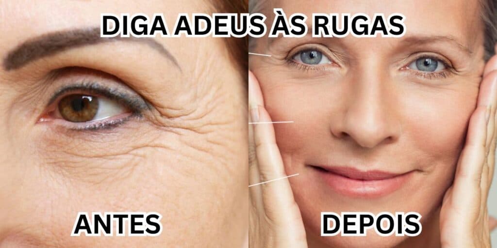 Adeus às rugas e pele perfeita sem plástica: Receita de botox caseiro vai salvar sua pele com 1 ingrediente