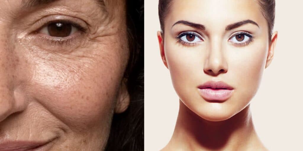 Demartologistas e clínicas de estética escondem: 5 sucos milagrosos pra ter uma pele de porcelana neste verão