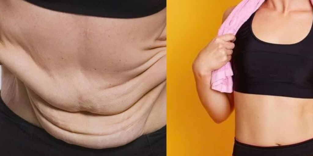 Pra acabar com flacidez e até o 'tchauzinho' no braço: 5 passos pra ter um corpo durinho até depois dos 50