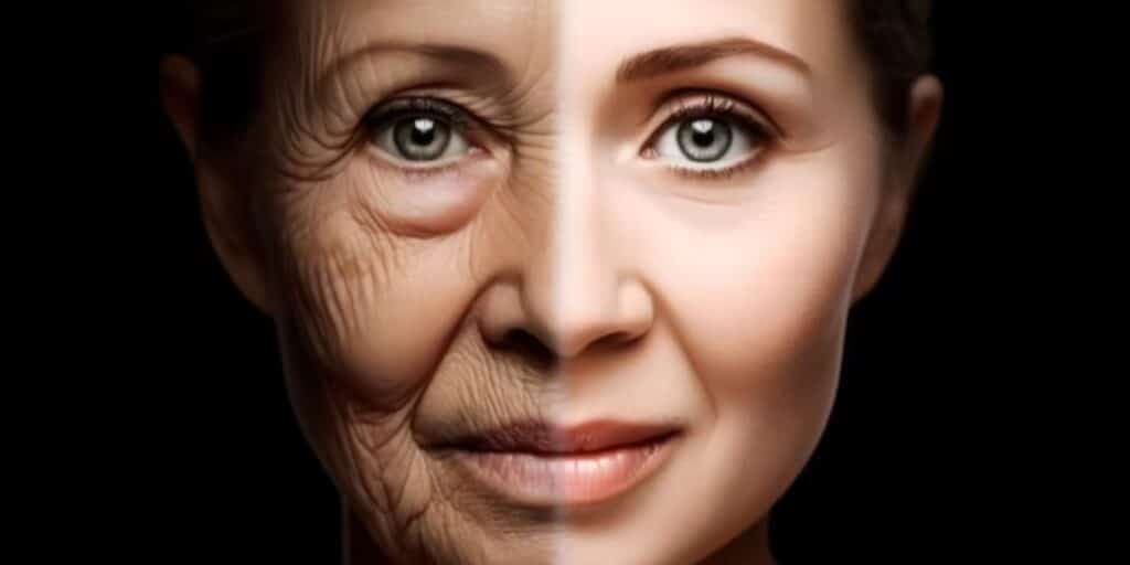 Mais potente que o botox: Misturinha caseira com 5 ingredientes para dar adeus às rugas e ter pele de bebê