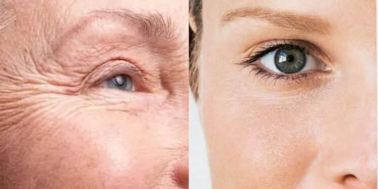 Sem rugas, manchas e espinhas: Misturinha com banana e +1 ingrediente rejuvenesce a pele só com 3 aplicações