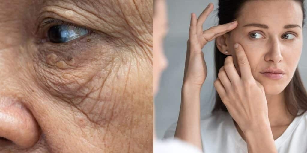 Fim das rugas e flacidez: Misturinha com 3 ingredientes do melhor colágeno traz resultado imediato