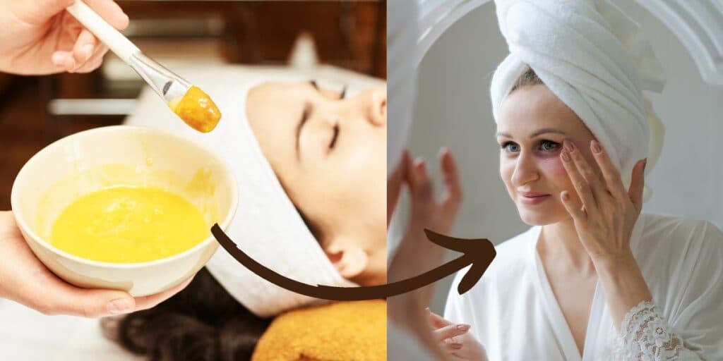 Até clínicas de estética sem acreditar: Receitinha com 4 ingredientes dá fim às rugas e é melhor que plástica
